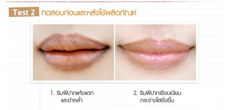 Chathy doll peeling gel liptox(ลิปยางลบสครับริมฝีปาก)