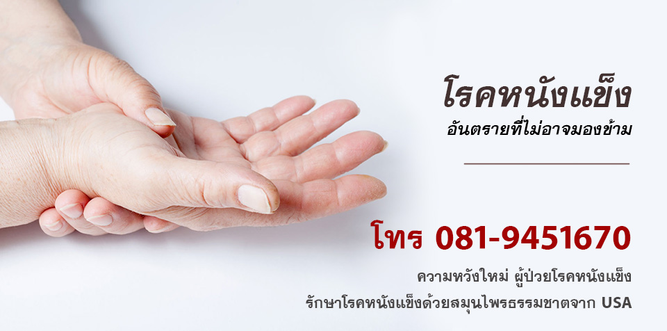 รักษาโรคหนังแข็ง Scleroderma สมุนไพรนำเข้าจาก USA