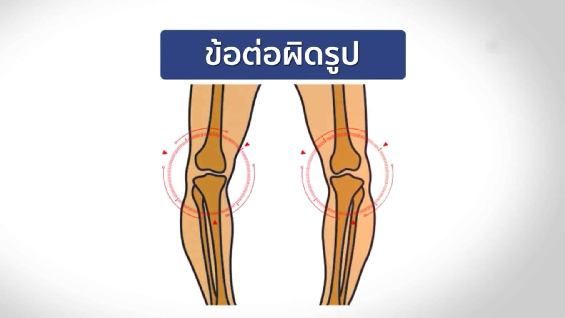 เวลยู คอลลาเจน ไทป์ทู