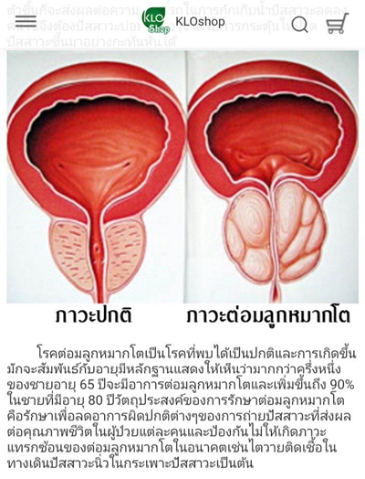 Khaolaor ขาวละออ แก๊กโคปีน ผงฟักข้าวผสมสารสกัดจากมะเขือเทศ 60 แคปซูล/ขวด ต่อมลูกหมากโต ผิวพรรณ